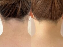 ドゥナ(DUNA)/ブライダルコース