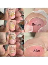 ネイルサロン アール(Nail salon R)