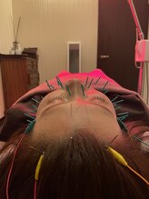 ポルクス鍼灸整骨院 表参道(Pollux鍼灸整骨院)/美容鍼灸