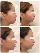 アネル 浦添店(anel)/