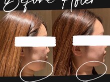 メル(mer)/小顔矯正