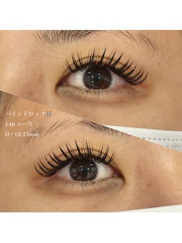 アイミー(eye me.)/バインドロック140本