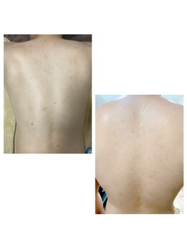 エルサ(Elsa)/陶肌