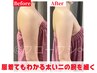 人気No3☆8月限定!痩せないぶよぶよ二の腕&ブラ上のハミ肉撃退!初回体験