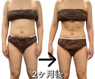 アラフェイス