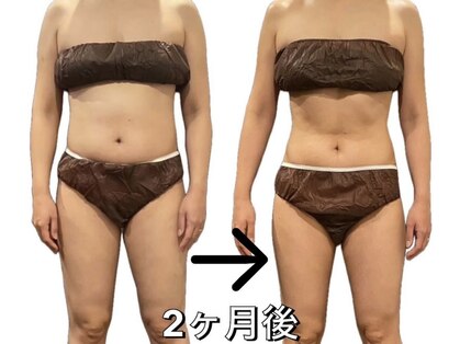 アラフェイスの写真