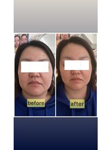 リリースパ 辻堂店(Lily spa)/浮腫/シミ/シワ/毛穴/ニキビ改善