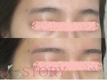 ストーリー(STORY)/眉毛と艶肌ワックス専門店