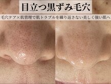 サロンドエテ(salon de ete)