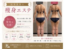 トータルビューティー ミミ(Total Beauty mimi)
