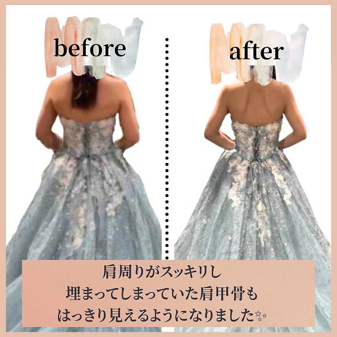 <A相談>[10kg迄\66,000~]選択体重までダイエット無期限通い放題+補償!150分\0