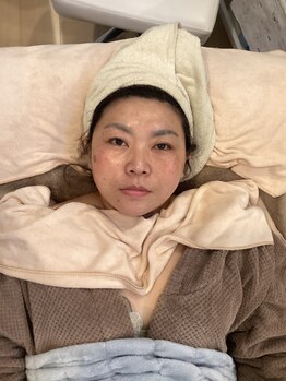 サナティオ(SANATIO)/オードリービューティーコース