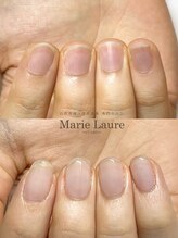マリーロール 梅田店(Marie Laure)/自爪育成/深爪矯正/ネイルケア