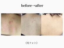 アルゴ 吹田千里山駅前店(ALGO)/【背中】光フォト