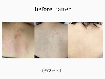 アルゴ 吹田千里山駅前店(ALGO)/【背中】光フォト