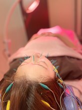 ポルクス鍼灸整骨院 表参道(Pollux鍼灸整骨院)/美容鍼灸