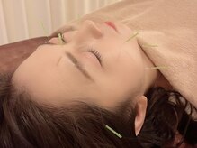 茶ノ木鍼灸整骨院/美容鍼 美肌トリートメント