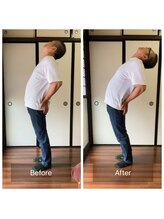 ミントのかべの整体院/施術ビフォーアフター