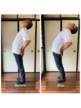 ミントのかべの整体院/施術ビフォーアフター