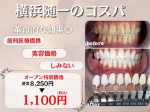 ピュアホワイトニング 横浜店