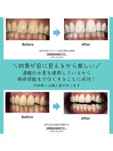 ミモアサロン 岡崎店(mimoaサロン)/歯科医認定サロンです