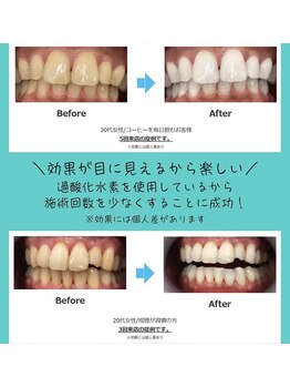 ミモアサロン 岡崎店(mimoaサロン)/歯科医認定サロンです