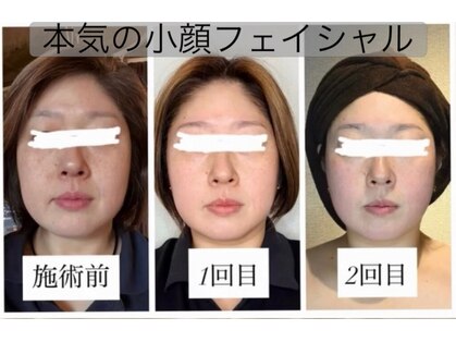 ココリ(CoCoRe)の写真