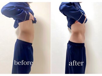 サンク(Cinq)/【骨盤矯正+整体】疲れ姿勢改善