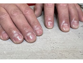 ヴィプラス(VIPLUZ)/men's nail