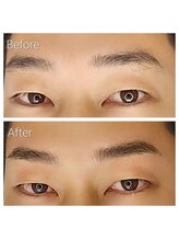 サンライズ(SUNRISE)/