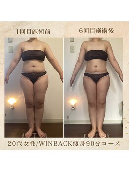 エソール(essor)/6回で驚きの変化!