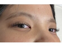 オランダエステティック(Holland Esthetics)/新規様 50/50