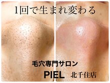 ピエル 北千住店(PIEL)/一回で生まれ変わる