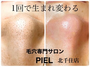 ピエル 北千住店(PIEL)/一回で生まれ変わる