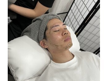 サムライビューティー 新宿三丁目店(SamuraiBeauty)/ フェイシャルピーリング