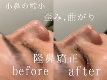 美人ヶ丘/自由が丘,小顔矯正,マッサージ