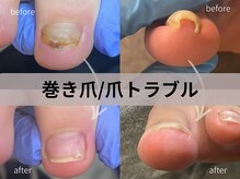 シュガーズネイル(sugar's nail)