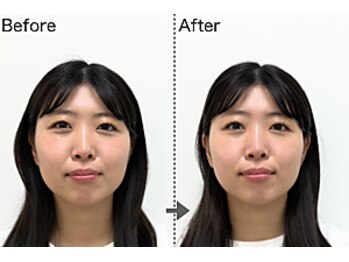 美容整体すこやか/BeforeーAfter