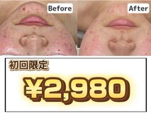 エピ エピ プラス イオンモール宇城店(EPI*EPI+)