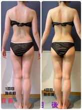 トリニティ 横浜店(TRINITY)/体重に変化なし