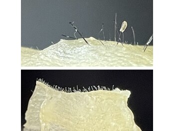 シエロ(Cielo)/産毛、垢、顔ダニ、角質