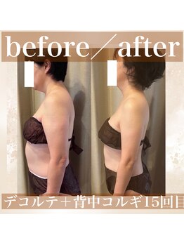 カモミール(chamomile)/BeforeAfter