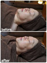 ウララ(ulala)/ララピールビフォアフ