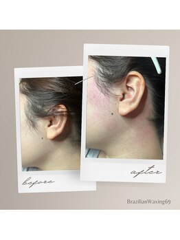 ブラジリアンワキシング シックスナイン(BrazilianWaxing69)/女性 / もみあげ