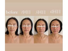 エスドット ビューティーサロン(S.beauty salon)/