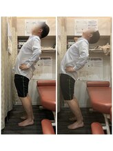 もりわき骨盤鍼灸整骨院 堺筋本町/◇血流改善後の変化1