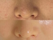 スーメ 柏(soome')/柏/まつげパーマ/眉毛/WAX