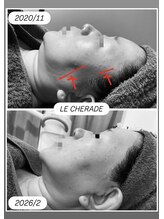 リシェラード/大人女子のためのシミケア