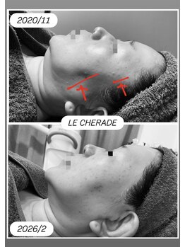 リシェラード/大人女子のためのシミケア