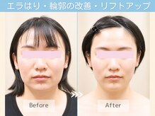 シンメトリー たまプラーザテラス店
